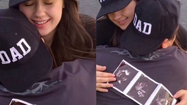 Billy Syahputra dan Vika Kolesnaya (instagram)